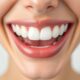 Tooth Loss