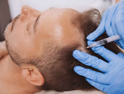 Hair Loss Treatment