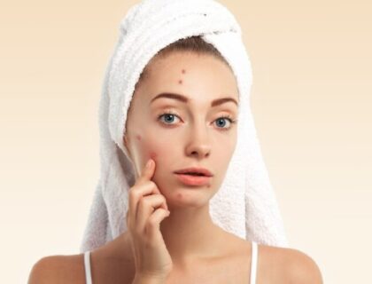 Skin Care Problems