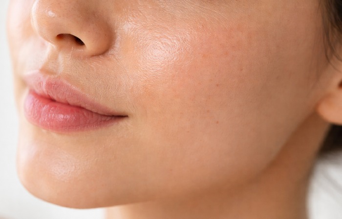 Close-up of oily facial skin with visible pores and mild uneven texture in natural lighting