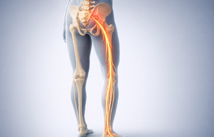 Proper form of figure four stretch for sciatica relief