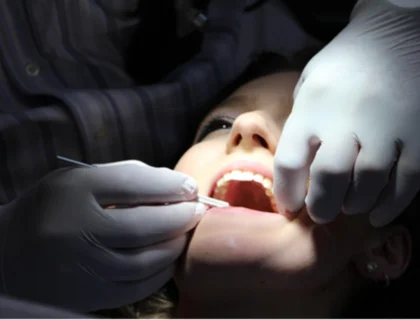 dental crowns