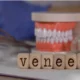 dental veneers