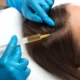 prp hair clinic